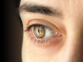 Casi 1.700 personas podrían padecer glaucoma en Segovia sin saberlo