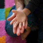 web propia para enfermedades raras