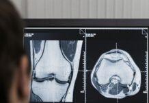 Radiología digital Segovia IV