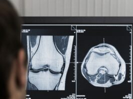 Radiología digital Segovia IV