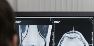 Radiología digital Segovia IV