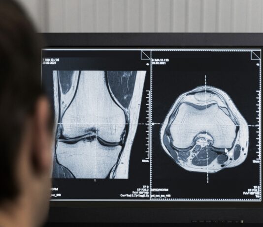 El centro de salud de Nueva Segovia tendrá una sala de radiología digital Radiología digital Segovia IV